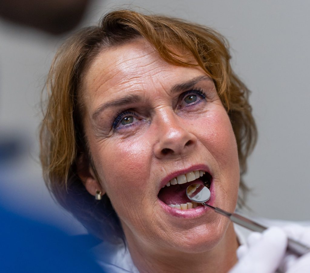 Gratis Kunstgebit Check Apeldoorn